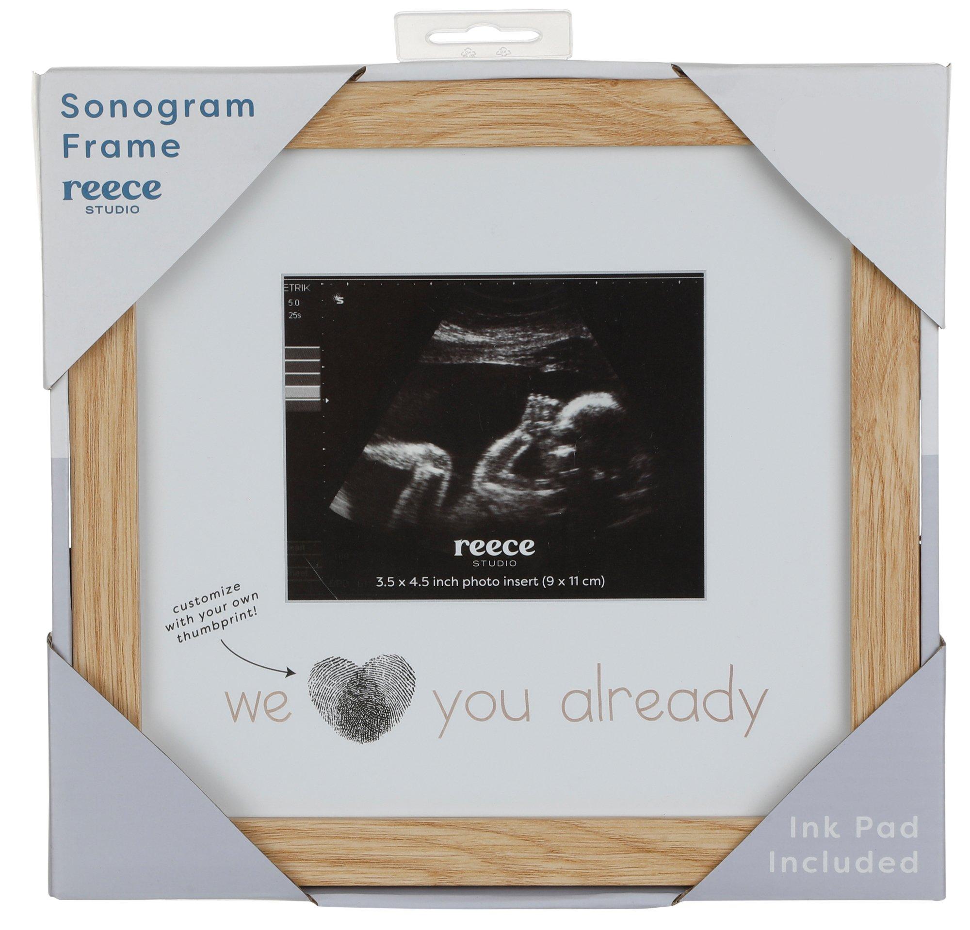 Baby Sonogram Frame
