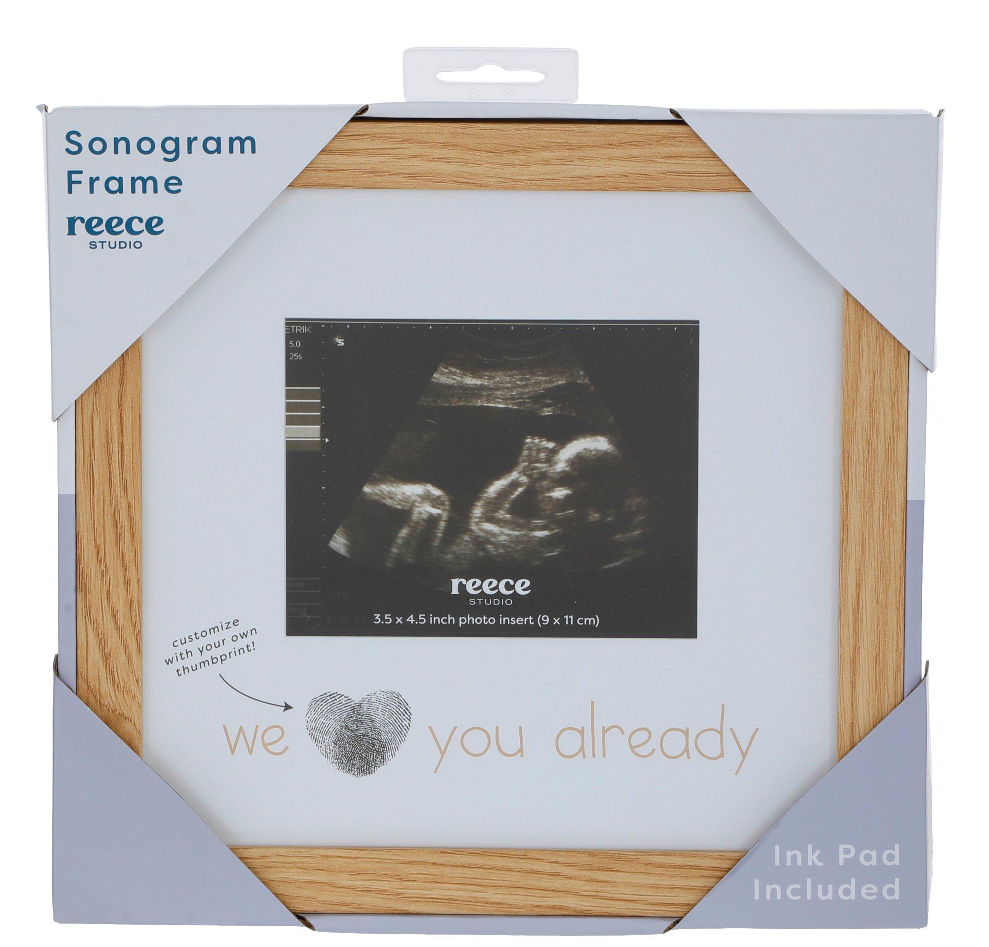 3x4 Sonogram Photo Frame